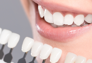 Bursa Diş Klinikliği I Lamine Diş Nedir?