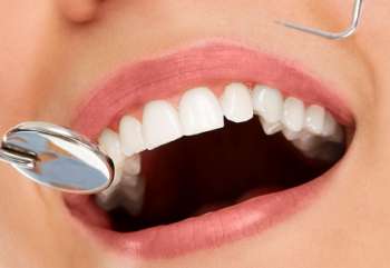 Sağlıklı Diş Etleri İçin Neler Yapmalı?