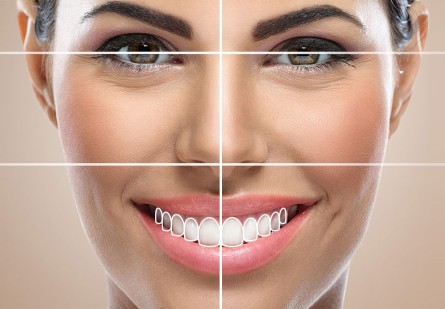 Smile Design