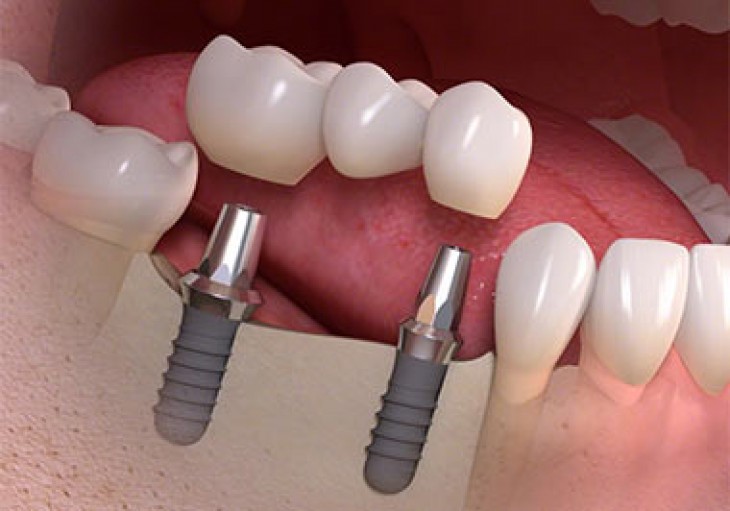 Oral And Maxıllofacıal Surgery