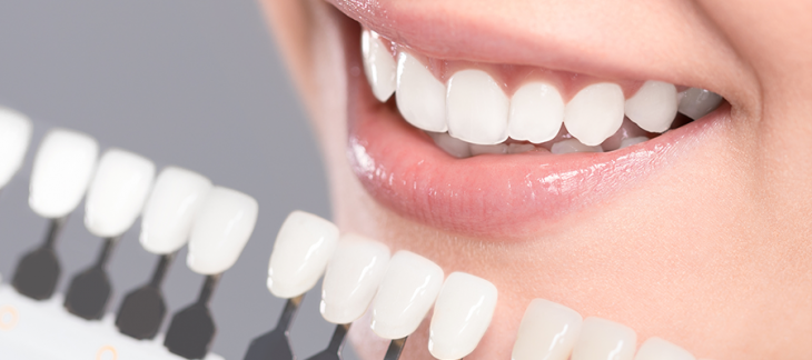 Bursa Diş Klinikliği I Lamine Diş Nedir?