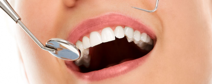 Sağlıklı Diş Etleri İçin Neler Yapmalı?