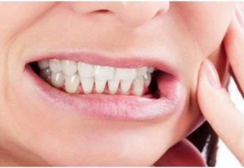 Diş Gıcırdatma Bruksizm Nedir?