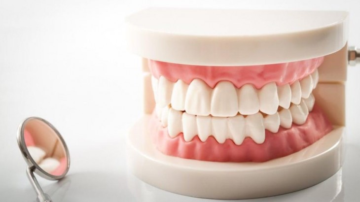 Estetik diş hekimliği protez çeşitleri