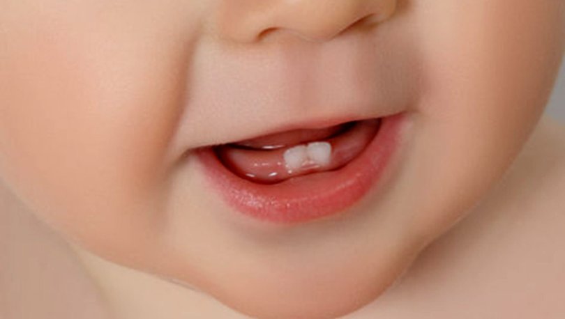 çocuk diş doktoru bursa - DM agiz ve dis saglıgı
