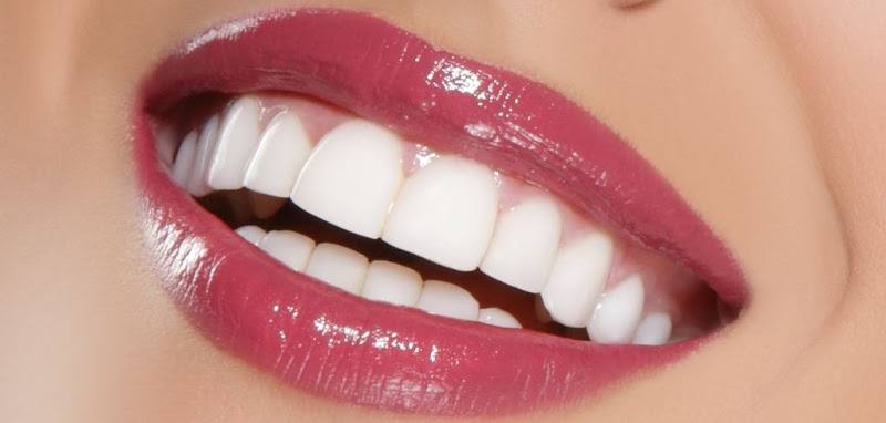 Diş estetiğii - DM agiz ve dis saglıgı