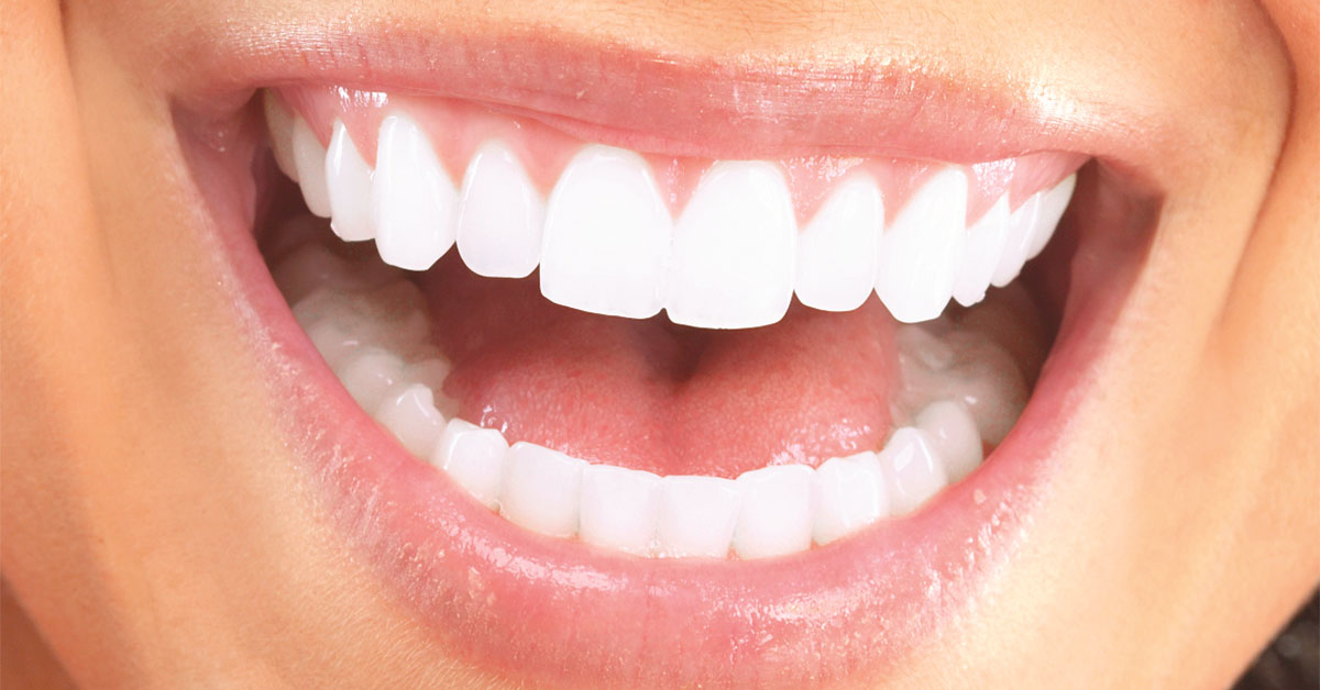 Bursa Lamina Diş Tedavisi - DM agiz ve dis saglıgı